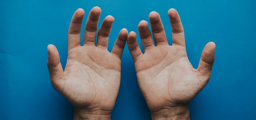 A person’s hands laid out, palms-up, against a blue background